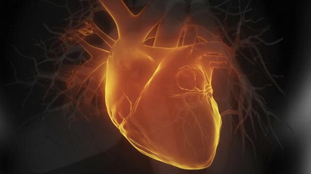 Complicaciones cardiovasculares asociadas a la acromegalia. Estado del arte