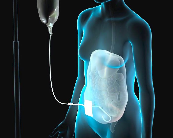 Relación del potasio y el fósforo séricos con el conocimiento nutricional y la ingesta dietética en pacientes en diálisis peritoneal